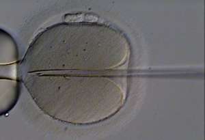 Zdjęcie mikroskopowe zapłodnienia metodą in vitro.