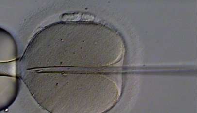 Zdjęcie mikroskopowe zapłodnienia metodą in vitro.