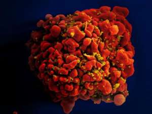 Komórka zainfekowana przez wirus HIV/flickr.com
